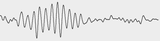 ЭЭГ с выраженным хорошо модулированным альфа ритмом частотой около 10 герц. Квантование 16 разрядное, частота дискретизации 200 герц.